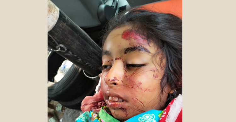 মতলব উত্তরে সড়ক দূর্ঘটনায় স্কুল ছাত্রী নিহত