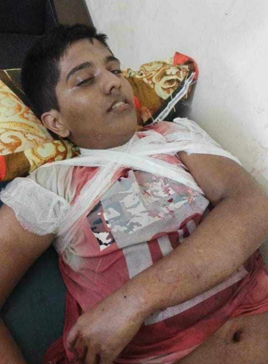 হাজীগঞ্জে সংঘর্ষের ঘটনায় পথচারী কিশোর সাইমুন মারা গেছে