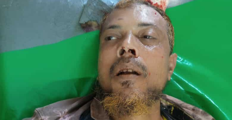 মতলবে ডেকোরেটর শ্রমিকের মৃত্যু