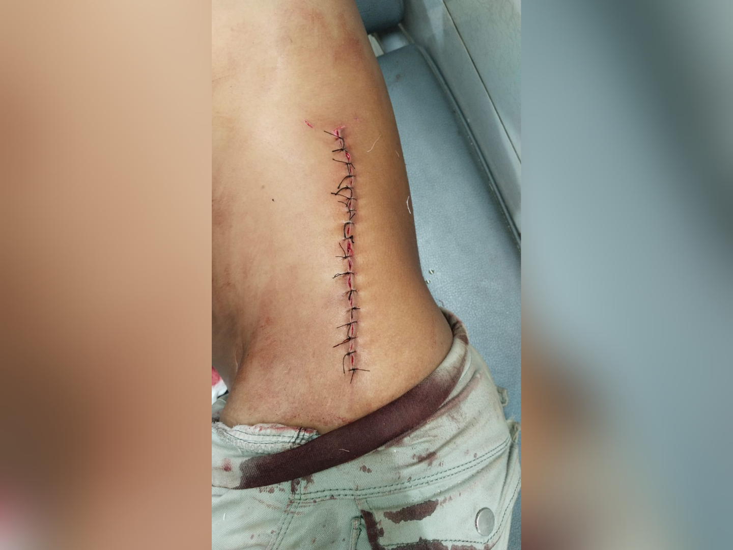 ফরিদগঞ্জে ছাত্রদলের দু পক্ষের সংঘর্ষ ও কার্যালয় ভাঙচুর, ছুরিকাঘাতে আহত ৬