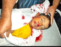 রায়পুরে অটোরিকশার ধাক্কায় শিশু নিহত