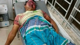 ফরিদগঞ্জে সড়ক দুর্ঘটনায় মোটরসাইকেল আরোহীর মৃত্যু