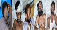 বলাখালে অজ্ঞাতদের হামলায় ১০ পরিবহন শ্রমিক আহত